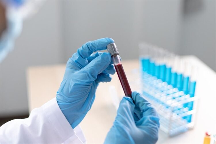 Geron Company’s Inventory Soars After FDA Approval